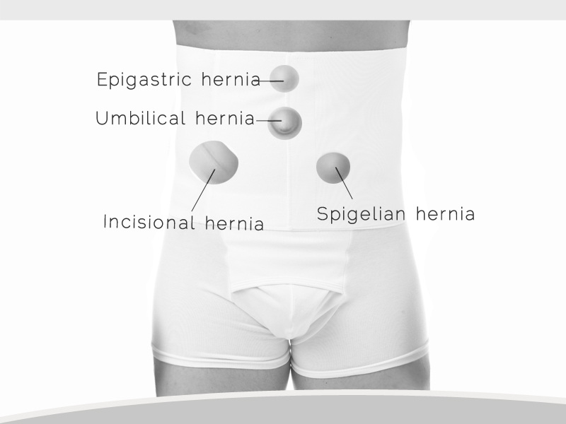 Underworks Men's and Women's Hernia Support 9-inch Tummy Trimming Belt with Velcro closure 345