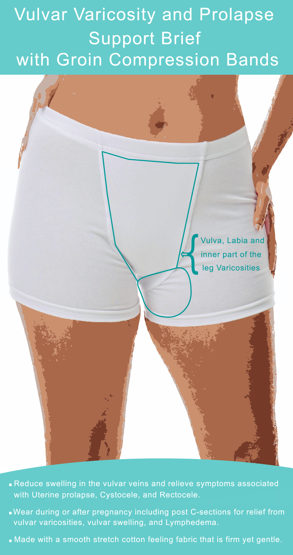 Underworks Vulvar Varicosity and Prolapse Support Brief with Groin  Compression Bands